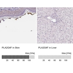 PLA2G4F Antibody, Novus Biologicals 25 &mu;L, Unlabeled:Antibodies, Polyclonal